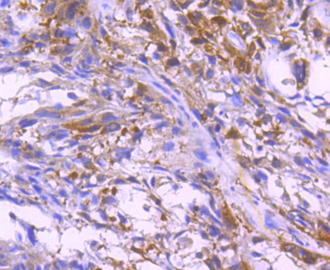 Immunohistochemical analysis of paraffin-embedded mouse testis tissue using anti-Paxillin antibody. The section was pre-treated using heat mediated antigen retrieval with Tris-EDTA buffer (pH 8.0-8.4) for 20 minutes.The tissues were blocked in 5% BSA for 30 minutes at room temperature, washed with ddH2O and PBS, and then probed with the primary antibody (ET1607-22, 1/50) for 30 minutes at room temperature. The detection was performed using an HRP conjugated compact polymer system. DAB was used as the chromogen. Tissues were counterstained with hematoxylin and mounted with DPX.