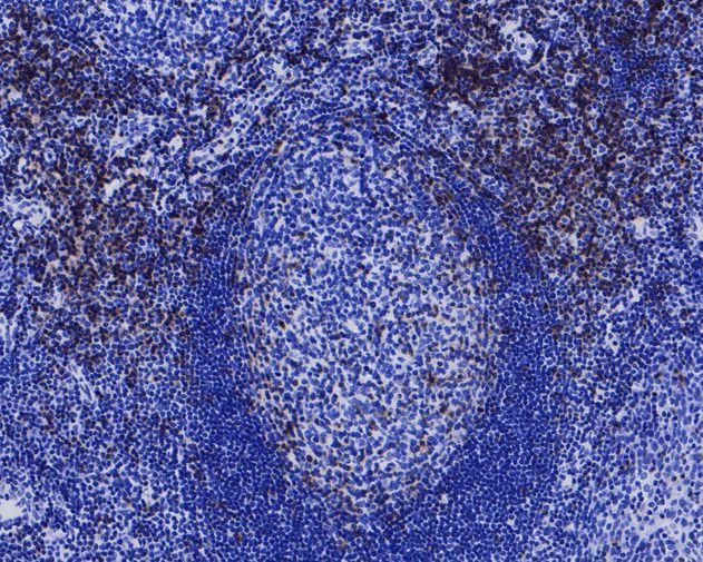 Immunohistochemical analysis of paraffin-embedded human tonsil tissue using anti-CD3 epsilon antibody. The section was pre-treated using heat mediated antigen retrieval with Tris-EDTA buffer (pH 8.0-8.4) for 20 minutes.The tissues were blocked in 5% BSA for 30 minutes at room temperature, washed with ddH2O and PBS, and then probed with the primary antibody (ET1607-29, 1/200) for 30 minutes at room temperature. The detection was performed using an HRP conjugated compact polymer system. DAB was used as the chromogen. Tissues were counterstained with hematoxylin and mounted with DPX.