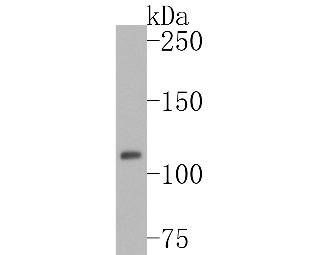 Western blot analysis of Phospho-JAK2(Y1007+Y1008) on Jurkat cell lysates. Proteins were transferred to a PVDF membrane and blocked with 5% BSA in PBS for 1 hour at room temperature. The primary antibody (ET1607-34, 1/500) was used in 5% BSA at room temperature for 2 hours. Goat Anti-Rabbit IgG - HRP Secondary Antibody (HA1001) at 1:200,000 dilution was used for 1 hour at room temperature.