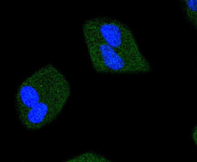 ICC staining of Phospho-JAK2(Y1007+Y1008) in Hela cells (green). Formalin fixed cells were permeabilized with 0.1% Triton X-100 in TBS for 10 minutes at room temperature and blocked with 1% Blocker BSA for 15 minutes at room temperature. Cells were probed with the primary antibody (ET1607-34, 1/50) for 1 hour at room temperature, washed with PBS. Alexa Fluor®488 Goat anti-Rabbit IgG was used as the secondary antibody at 1/1,000 dilution. The nuclear counter stain is DAPI (blue).