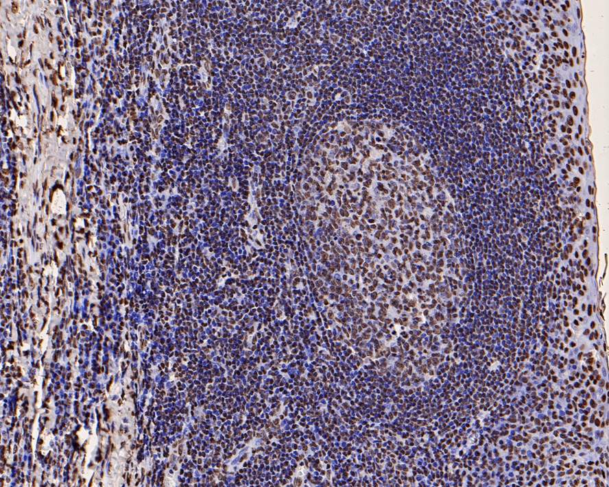 Immunohistochemical analysis of paraffin-embedded human tonsil tissue using anti-Phospho-JAK2(Y1007+Y1008) antibody. The section was pre-treated using heat mediated antigen retrieval with sodium citrate buffer (pH 6.0) for 20 minutes. The tissues were blocked in 5% BSA for 30 minutes at room temperature, washed with ddH2O and PBS, and then probed with the primary antibody (ET1607-34, 1/200)  for 30 minutes at room temperature. The detection was performed using an HRP conjugated compact polymer system. DAB was used as the chromogen. Tissues were counterstained with hematoxylin and mounted with DPX.