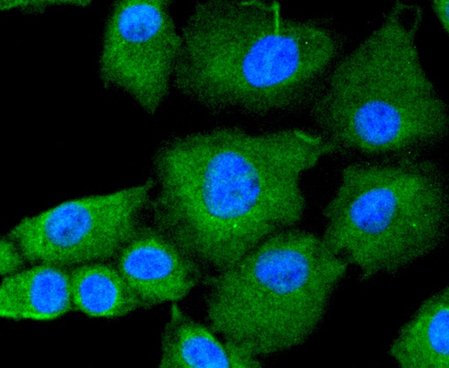 ICC staining JAK2 in A549 cells (green). The nuclear counter stain is DAPI (blue). Cells were fixed in paraformaldehyde, permeabilised with 0.25% Triton X100/PBS.