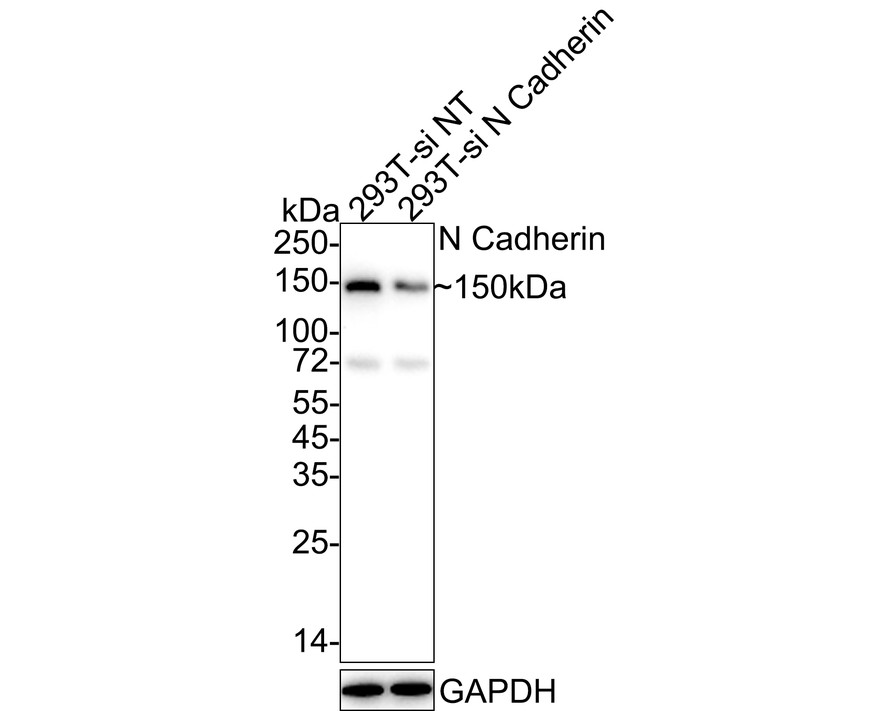Western blot analysis of N Cadherin on different lysates with Rabbit anti-N Cadherin antibody (ET1607-37) at 1/5,000 dilution.<br />
<br />
Lane 1: 293T-si NT cell lysate (10 µg/Lane)<br />
Lane 2: 293T-si N Cadherin cell lysate (10 µg/Lane)<br />
<br />
Predicted band size: 100 kDa<br />
Observed band size: 150 kDa<br />
<br />
Exposure time: 1 minute 46 seconds;<br />
<br />
4-20% SDS-PAGE gel.<br />
<br />
Proteins were transferred to a PVDF membrane and blocked with 5% NFDM/TBST for 1 hour at room temperature. The primary antibody (ET1607-37) at 1/5,000 dilution was used in 5% NFDM/TBST at 4℃ overnight. Goat Anti-Rabbit IgG - HRP Secondary Antibody (HA1001) at 1/50,000 dilution was used for 1 hour at room temperature.
