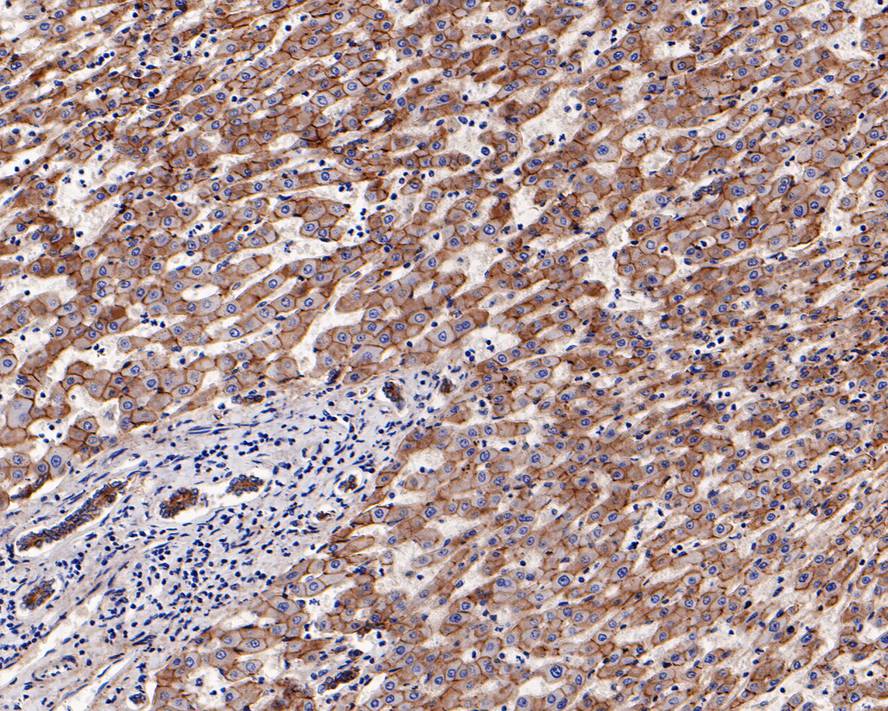 Immunohistochemical analysis of paraffin-embedded human liver tissue using anti-N Cadherin antibody. The section was pre-treated using heat mediated antigen retrieval with Tris-EDTA buffer (pH 8.0-8.4) for 20 minutes.The tissues were blocked in 5% BSA for 30 minutes at room temperature, washed with ddH2O and PBS, and then probed with the primary antibody (ET1607-37, 1/50) for 30 minutes at room temperature. The detection was performed using an HRP conjugated compact polymer system. DAB was used as the chromogen. Tissues were counterstained with hematoxylin and mounted with DPX.