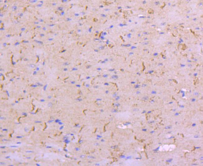 Immunohistochemical analysis of paraffin-embedded mouse heart tissue using anti-N Cadherin antibody. The section was pre-treated using heat mediated antigen retrieval with Tris-EDTA buffer (pH 8.0-8.4) for 20 minutes.The tissues were blocked in 5% BSA for 30 minutes at room temperature, washed with ddH2O and PBS, and then probed with the primary antibody (ET1607-37, 1/50) for 30 minutes at room temperature. The detection was performed using an HRP conjugated compact polymer system. DAB was used as the chromogen. Tissues were counterstained with hematoxylin and mounted with DPX.