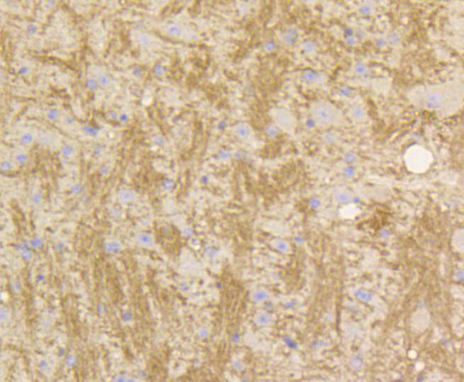 Immunohistochemical analysis of paraffin-embedded mouse brain tissue using anti-STAT3 antibody. The section was pre-treated using heat mediated antigen retrieval with Tris-EDTA buffer (pH 8.0-8.4) for 20 minutes.The tissues were blocked in 5% BSA for 30 minutes at room temperature, washed with ddH2O and PBS, and then probed with the primary antibody (ET1607-38, 1/50) for 30 minutes at room temperature. The detection was performed using an HRP conjugated compact polymer system. DAB was used as the chromogen. Tissues were counterstained with hematoxylin and mounted with DPX.