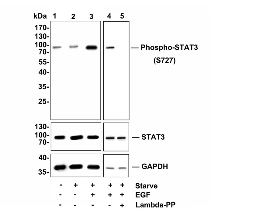 Western blot analysis of Phospho-STAT3(S727) on NIH-3T3 cell lysates.<br />
<br />
Lane 1: NIH-3T3 cells, whole cell lysates, 10 μg/lane.<br />
Lane 2: NIH-3T3 cells were starved 6h, whole cell lysates, 10 μg/lane.<br />
Lane 3/4: NIH-3T3 cells were starved 6h, then treated with 200 ng/ml EGF for 10 min, whole cell lysates, 10 μg/lane.<br />
Lane 5: NIH-3T3 cells were starved 6h, then treated with 200 ng/ml EGF for 10 min, and then treated with 2.8μg/ul lambda-PP for 30 minutes, whole cell lysates, 10 μg/lane.<br />
<br />
Proteins were transferred to a PVDF membrane and blocked with 5% BSA in PBS for 1 hour at room temperature. The primary antibody Anti-Phospho-STAT3(S727)(ET1607-39, 1/500) , Anti-STAT3 antibody ( ET1607-38, 1/500) and Anti-GAPDH antibody (ET1601-4, 1/10,000)was used in 5% BSA at room temperature for 2 hours. Goat Anti-Rabbit IgG H&L (HRP) Secondary Antibody (HA1001) at 1:200,000 dilution was used for 1 hour at room temperature.<br />
<br />
Predicted band size: 88 kDa<br />
Observed band size: 88 kDa<br />
Exposure time: Lane 1/2/3  1 minute 28 seconds<br />
                         Lane 4/5  30 seconds