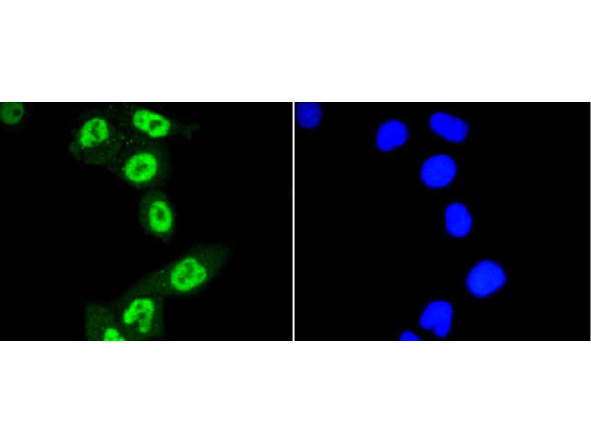 ICC staining of Phospho-STAT3 (S727) in Hela cells (green). Formalin fixed cells were permeabilized with 0.1% Triton X-100 in TBS for 10 minutes at room temperature and blocked with 1% Blocker BSA for 15 minutes at room temperature. Cells were probed with the primary antibody (ET1607-39, 1/50) for 1 hour at room temperature, washed with PBS. Alexa Fluor®488 Goat anti-Rabbit IgG was used as the secondary antibody at 1/1,000 dilution. The nuclear counter stain is DAPI (blue).