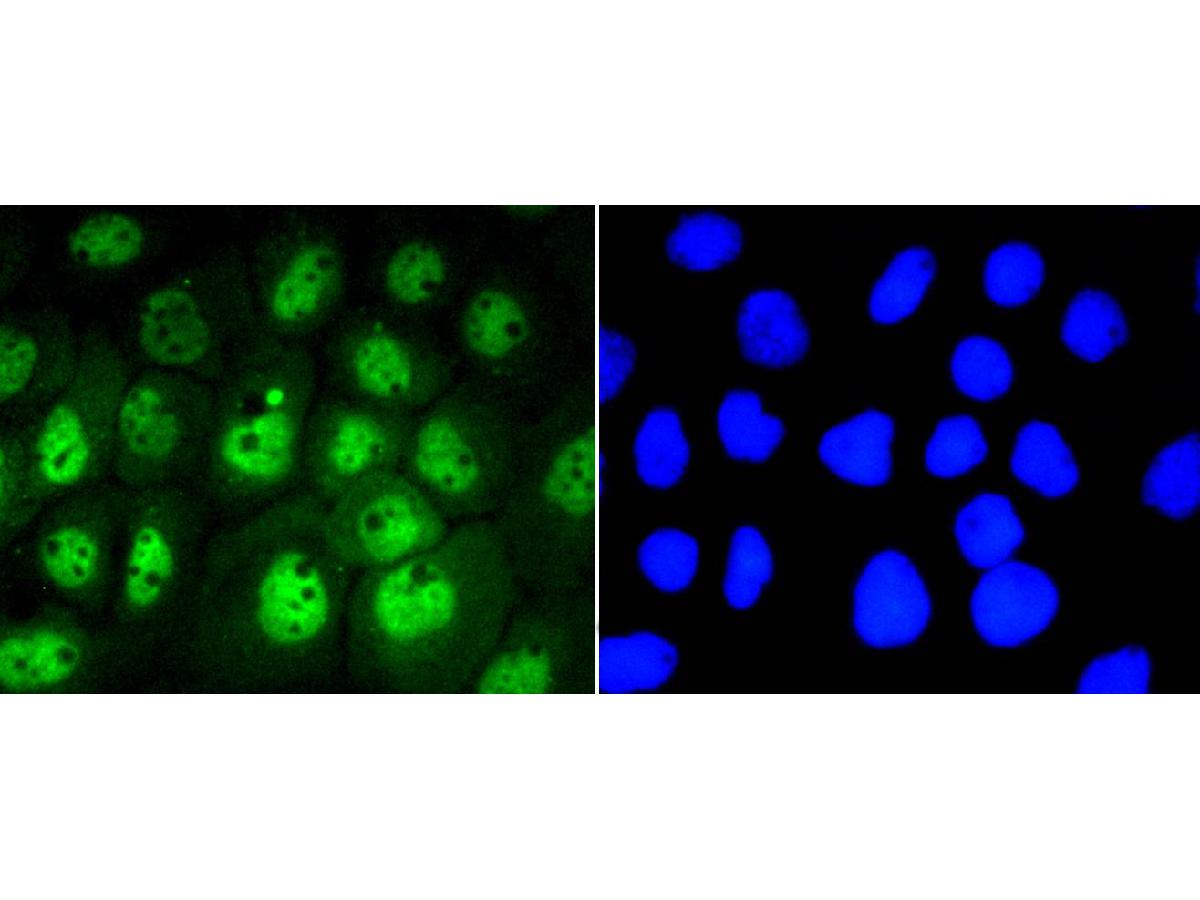 ICC staining of Phospho-STAT3 (S727) in A431 cells (green). Formalin fixed cells were permeabilized with 0.1% Triton X-100 in TBS for 10 minutes at room temperature and blocked with 1% Blocker BSA for 15 minutes at room temperature. Cells were probed with the primary antibody (ET1607-39, 1/50) for 1 hour at room temperature, washed with PBS. Alexa Fluor®488 Goat anti-Rabbit IgG was used as the secondary antibody at 1/1,000 dilution. The nuclear counter stain is DAPI (blue).