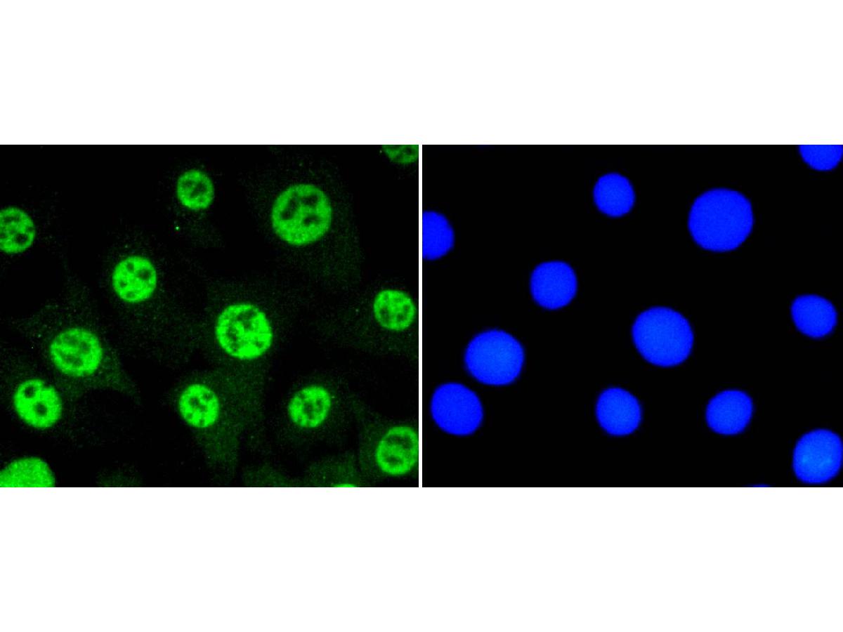 ICC staining of Phospho-STAT3 (S727) in NIH/3T3 cells (green). Formalin fixed cells were permeabilized with 0.1% Triton X-100 in TBS for 10 minutes at room temperature and blocked with 1% Blocker BSA for 15 minutes at room temperature. Cells were probed with the primary antibody (ET1607-39, 1/50) for 1 hour at room temperature, washed with PBS. Alexa Fluor®488 Goat anti-Rabbit IgG was used as the secondary antibody at 1/1,000 dilution. The nuclear counter stain is DAPI (blue).