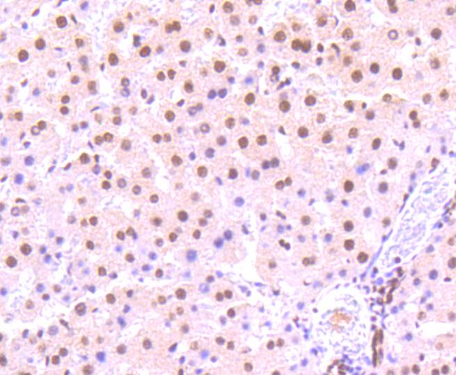 Immunohistochemical analysis of paraffin-embedded rat liver tissue using anti-Phospho-STAT3 (S727) antibody. The section was pre-treated using heat mediated antigen retrieval with Tris-EDTA buffer (pH 8.0-8.4) for 20 minutes.The tissues were blocked in 5% BSA for 30 minutes at room temperature, washed with ddH2O and PBS, and then probed with the primary antibody (ET1607-39, 1/50) for 30 minutes at room temperature. The detection was performed using an HRP conjugated compact polymer system. DAB was used as the chromogen. Tissues were counterstained with hematoxylin and mounted with DPX.