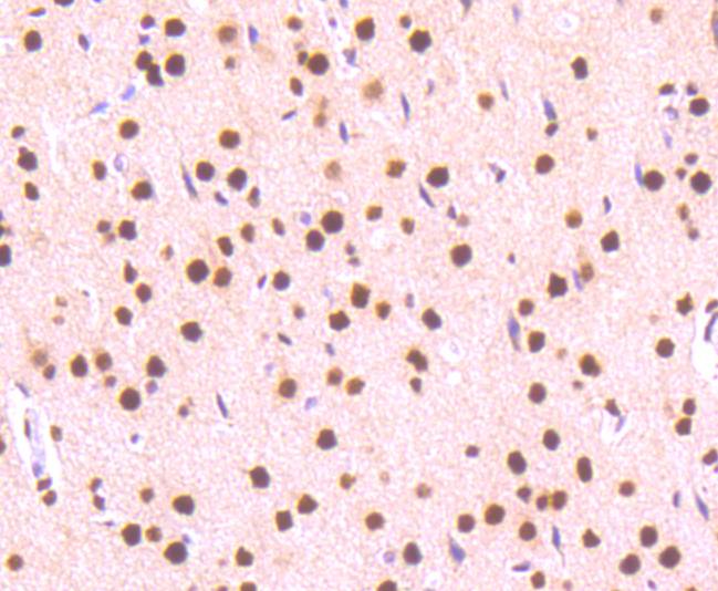 Immunohistochemical analysis of paraffin-embedded rat brain tissue using anti-Phospho-STAT3 (S727) antibody. The section was pre-treated using heat mediated antigen retrieval with Tris-EDTA buffer (pH 8.0-8.4) for 20 minutes.The tissues were blocked in 5% BSA for 30 minutes at room temperature, washed with ddH2O and PBS, and then probed with the primary antibody (ET1607-39, 1/50) for 30 minutes at room temperature. The detection was performed using an HRP conjugated compact polymer system. DAB was used as the chromogen. Tissues were counterstained with hematoxylin and mounted with DPX.