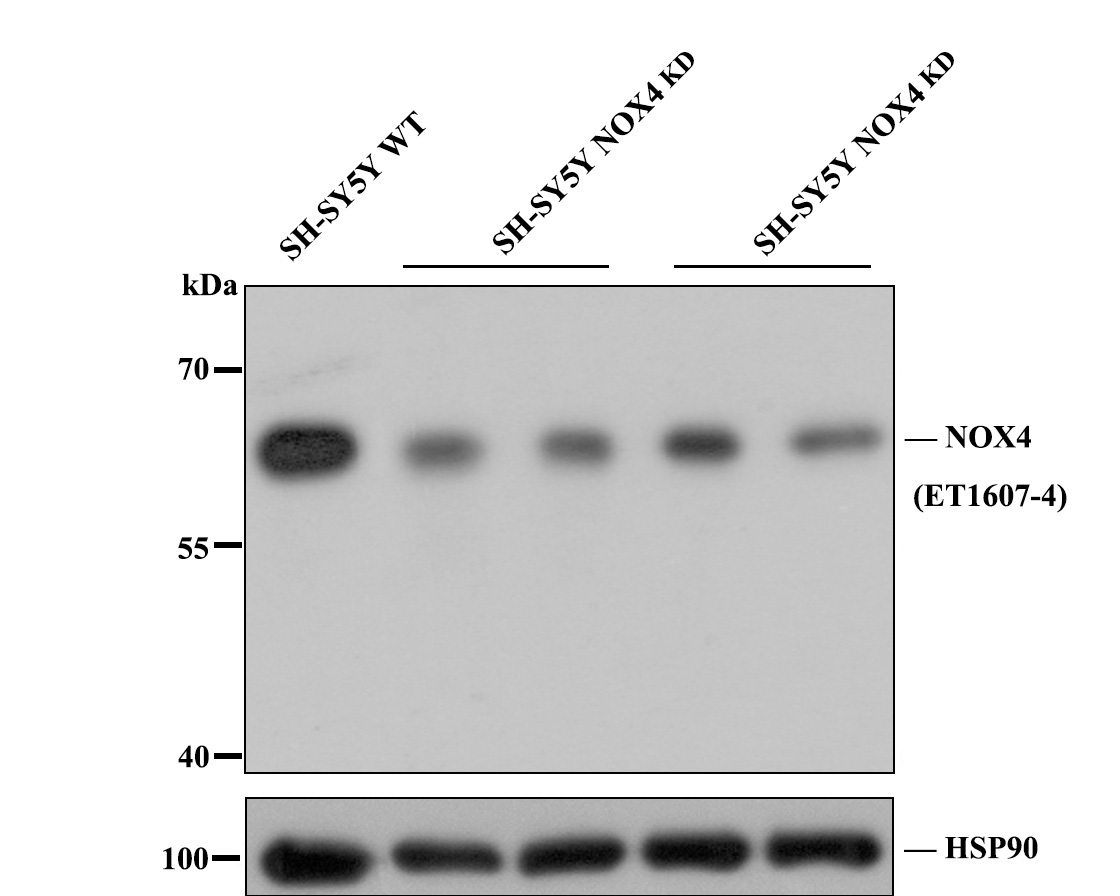 All lanes: Western blot analysis of NOX4 with anti-NOX4 antibody [SY0214] (ET1607-4) at 1:1,000 dilution.<br />
<br />
Lane 1: Wild-type SH-SY5Y whole cell lysate (20 µg).<br />
Lane 2/3: NOX4 fragment 1 knockdown SH-SY5Y whole cell lysate (20 µg).<br />
Lane 4/5: NOX4 fragment 2 knockdown SH-SY5Y whole cell lysate (20 µg).<br />
<br />
ET1607-4 was shown to specifically react with NOX4 in wild-type SH-SY5Y cells. Weakened bands were observed when NOX4 knockdown samples were tested. Wild-type and NOX4 knockdown samples were subjected to SDS-PAGE. Proteins were transferred to a PVDF membrane and blocked with 5% NFDM in TBST for 1 hour at room temperature. The primary antibody (ET1607-4, 1/1,000) and Loading control antibody(Rabbit anti-HSP90, ET1605-56, 1/10,000) were used in 5% BSA at room temperature for 2 hours. Goat Anti-Rabbit IgG-HRP Secondary Antibody (HA1001) at 1:200,000 dilution was used for 1 hour at room temperature.