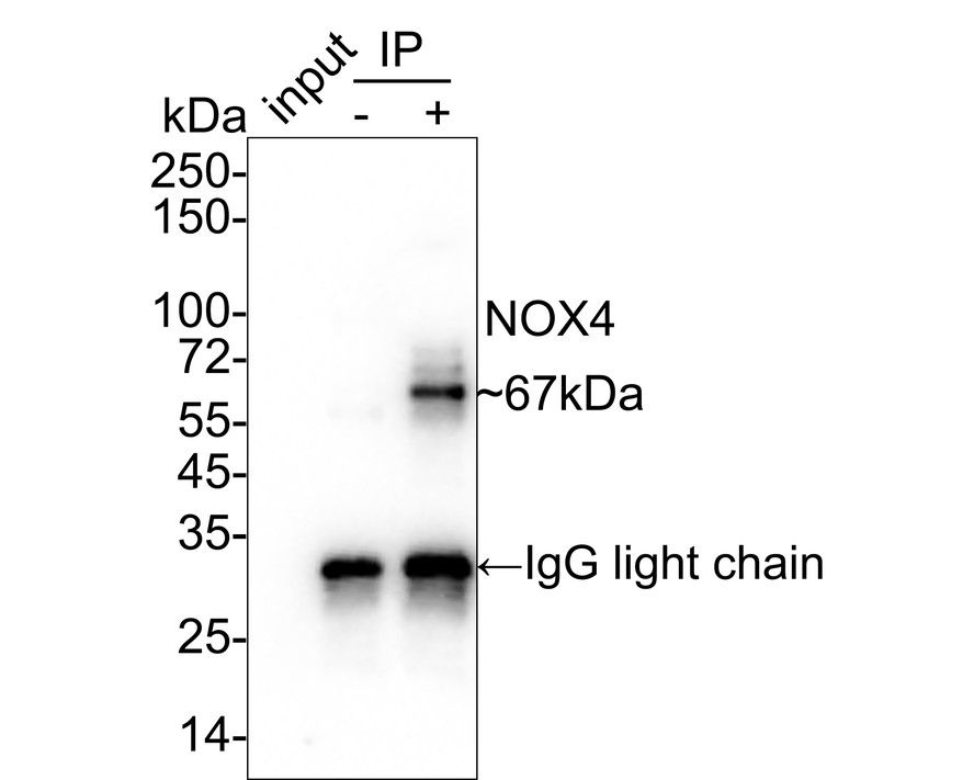 NADPH oxidase 4/NOX4 was immunoprecipitated in 0.2mg SH-SY5Y cell lysate with ET1607-4 at 2 µg/25 µl agarose. Western blot was performed from the immunoprecipitate using ET1607-4 at 1/1,000 dilution. Anti-Rabbit IgG for IP Nano-secondary antibody (NBI01H) at 1/5,000 dilution was used for 1 hour at room temperature.<br />
<br />
Lane 1: SH-SY5Y cell lysate (input)<br />
Lane 2: Rabbit IgG instead of ET1607-4 in SH-SY5Y cell lysate<br />
Lane 3: ET1607-4 IP in SH-SY5Y cell lysate<br />
<br />
Blocking/Dilution buffer: 5% NFDM/TBST<br />
Exposure time: 24 seconds