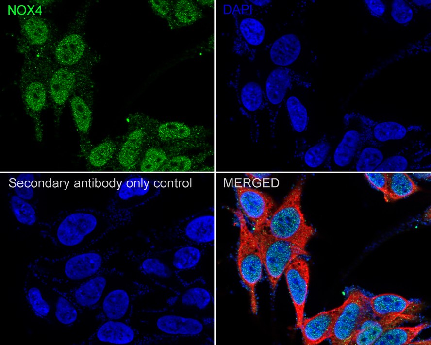 ICC staining of NADPH oxidase 4/NOX4 in Hela cells (green). Formalin fixed cells were permeabilized with 0.1% Triton X-100 in TBS for 10 minutes at room temperature and blocked with 10% negative goat serum for 15 minutes at room temperature. Cells were probed with the primary antibody (ET1607-4, 1/50) for 1 hour at room temperature, washed with PBS. Alexa Fluor®488 conjugate-Goat anti-Rabbit IgG was used as the secondary antibody at 1/1,000 dilution. The nuclear counter stain is DAPI (blue).