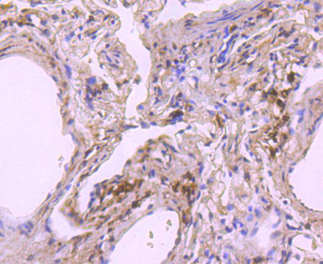 Immunohistochemical analysis of paraffin-embedded human lung tissue using anti-NADPH oxidase 4/NOX4 antibody. The section was pre-treated using heat mediated antigen retrieval with Tris-EDTA buffer (pH 9.0) for 20 minutes.The tissues were blocked in 1% BSA for 30 minutes at room temperature, washed with ddH2O and PBS, and then probed with the primary antibody (ET1607-4, 1/50) for 30 minutes at room temperature. The detection was performed using an HRP conjugated compact polymer system. DAB was used as the chromogen. Tissues were counterstained with hematoxylin and mounted with DPX.