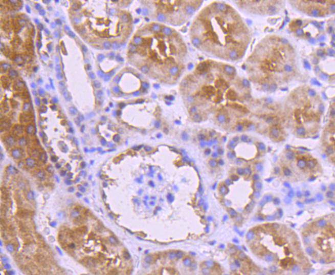 Immunohistochemical analysis of paraffin-embedded human kidney tissue using anti-NADPH oxidase 4/NOX4 antibody. The section was pre-treated using heat mediated antigen retrieval with Tris-EDTA buffer (pH 9.0) for 20 minutes.The tissues were blocked in 1% BSA for 30 minutes at room temperature, washed with ddH2O and PBS, and then probed with the primary antibody (ET1607-4, 1/50) for 30 minutes at room temperature. The detection was performed using an HRP conjugated compact polymer system. DAB was used as the chromogen. Tissues were counterstained with hematoxylin and mounted with DPX.