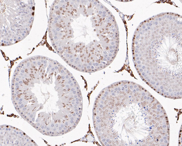 Immunohistochemical analysis of paraffin-embedded mouse liver tissue using anti-Smad3 antibody. The section was pre-treated using heat mediated antigen retrieval with Tris-EDTA buffer (pH 8.0-8.4) for 20 minutes.The tissues were blocked in 5% BSA for 30 minutes at room temperature, washed with ddH2O and PBS, and then probed with the primary antibody (ET1607-41, 1/50) for 30 minutes at room temperature. The detection was performed using an HRP conjugated compact polymer system. DAB was used as the chromogen. Tissues were counterstained with hematoxylin and mounted with DPX.