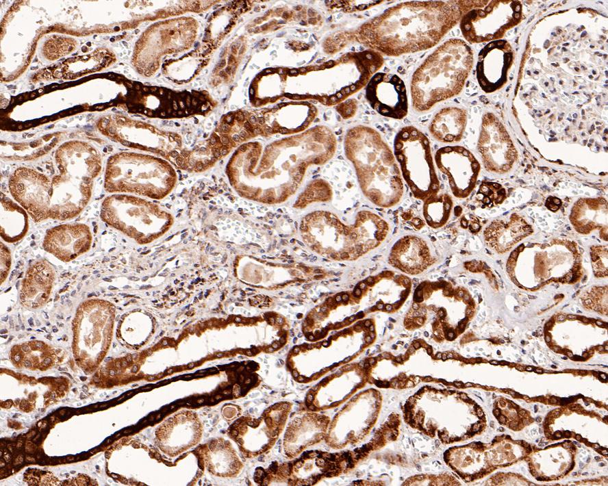 Immunohistochemical analysis of paraffin-embedded mouse brain tissue using anti-Smad3 antibody. The section was pre-treated using heat mediated antigen retrieval with Tris-EDTA buffer (pH 8.0-8.4) for 20 minutes.The tissues were blocked in 5% BSA for 30 minutes at room temperature, washed with ddH2O and PBS, and then probed with the primary antibody (ET1607-41, 1/50) for 30 minutes at room temperature. The detection was performed using an HRP conjugated compact polymer system. DAB was used as the chromogen. Tissues were counterstained with hematoxylin and mounted with DPX.
