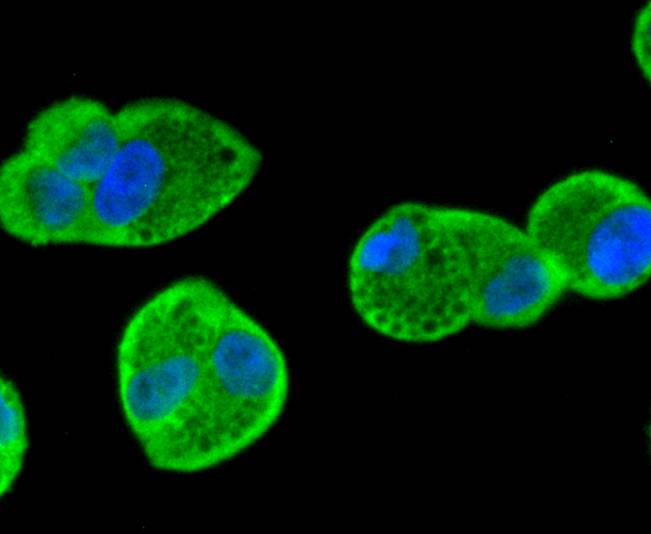 ICC staining of Smad1 in Hela cells (green). Formalin fixed cells were permeabilized with 0.1% Triton X-100 in TBS for 10 minutes at room temperature and blocked with 1% Blocker BSA for 15 minutes at room temperature. Cells were probed with the primary antibody (ET1607-42, 1/50) for 1 hour at room temperature, washed with PBS. Alexa Fluor®488 Goat anti-Rabbit IgG was used as the secondary antibody at 1/1,000 dilution. The nuclear counter stain is DAPI (blue).