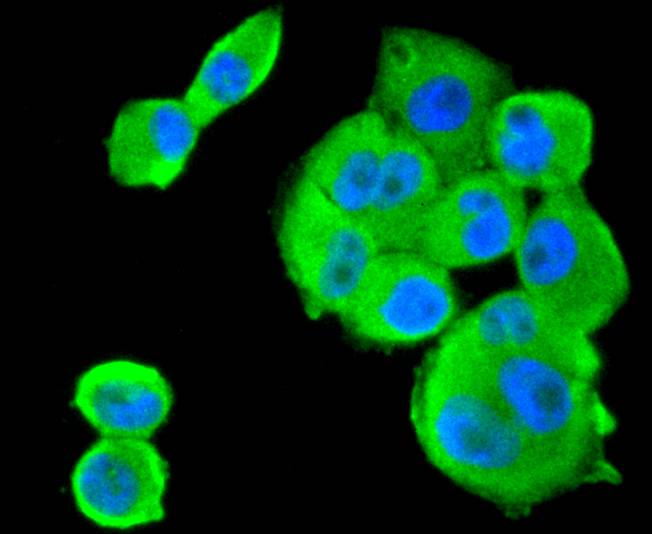 ICC staining of Smad1 in PANC-1 cells (green). Formalin fixed cells were permeabilized with 0.1% Triton X-100 in TBS for 10 minutes at room temperature and blocked with 1% Blocker BSA for 15 minutes at room temperature. Cells were probed with the primary antibody (ET1607-42, 1/50) for 1 hour at room temperature, washed with PBS. Alexa Fluor®488 Goat anti-Rabbit IgG was used as the secondary antibody at 1/1,000 dilution. The nuclear counter stain is DAPI (blue).