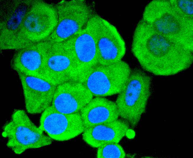 ICC staining of Smad1 in MCF-7 cells (green). Formalin fixed cells were permeabilized with 0.1% Triton X-100 in TBS for 10 minutes at room temperature and blocked with 1% Blocker BSA for 15 minutes at room temperature. Cells were probed with the primary antibody (ET1607-42, 1/50) for 1 hour at room temperature, washed with PBS. Alexa Fluor®488 Goat anti-Rabbit IgG was used as the secondary antibody at 1/1,000 dilution. The nuclear counter stain is DAPI (blue).