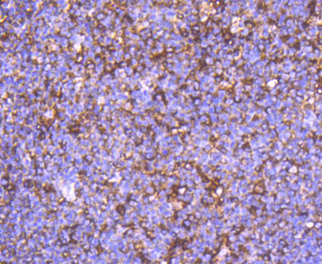 Immunohistochemical analysis of paraffin-embedded human tonsil tissue using anti-alpha smooth muscle Actin antibody. The section was pre-treated using heat mediated antigen retrieval with Tris-EDTA buffer (pH 8.0-8.4) for 20 minutes.The tissues were blocked in 5% BSA for 30 minutes at room temperature, washed with ddH2O and PBS, and then probed with the primary antibody (ET1607-43, 1/50) for 30 minutes at room temperature. The detection was performed using an HRP conjugated compact polymer system. DAB was used as the chromogen. Tissues were counterstained with hematoxylin and mounted with DPX.