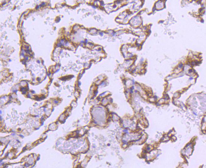 Immunohistochemical analysis of paraffin-embedded human liver tissue using anti-alpha smooth muscle Actin antibody. The section was pre-treated using heat mediated antigen retrieval with Tris-EDTA buffer (pH 8.0-8.4) for 20 minutes.The tissues were blocked in 5% BSA for 30 minutes at room temperature, washed with ddH2O and PBS, and then probed with the primary antibody (ET1607-43, 1/50) for 30 minutes at room temperature. The detection was performed using an HRP conjugated compact polymer system. DAB was used as the chromogen. Tissues were counterstained with hematoxylin and mounted with DPX.