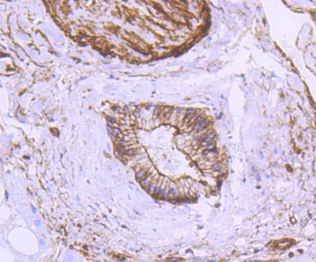 Immunohistochemical analysis of paraffin-embedded mouse skin tissue using anti-alpha smooth muscle Actin antibody. The section was pre-treated using heat mediated antigen retrieval with Tris-EDTA buffer (pH 8.0-8.4) for 20 minutes.The tissues were blocked in 5% BSA for 30 minutes at room temperature, washed with ddH2O and PBS, and then probed with the primary antibody (ET1607-43, 1/50) for 30 minutes at room temperature. The detection was performed using an HRP conjugated compact polymer system. DAB was used as the chromogen. Tissues were counterstained with hematoxylin and mounted with DPX.