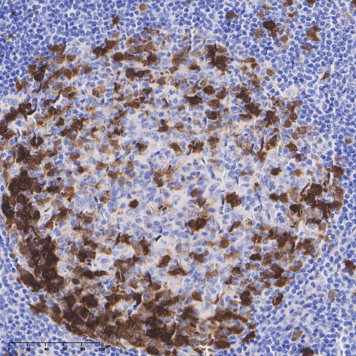 ICC staining of CDK1 in A431 cells (green). Formalin fixed cells were permeabilized with 0.1% Triton X-100 in TBS for 10 minutes at room temperature and blocked with 1% Blocker BSA for 15 minutes at room temperature. Cells were probed with the primary antibody (ET1607-51, 1/50) for 1 hour at room temperature, washed with PBS. Alexa Fluor®488 Goat anti-Rabbit IgG was used as the secondary antibody at 1/1,000 dilution. The nuclear counter stain is DAPI (blue).