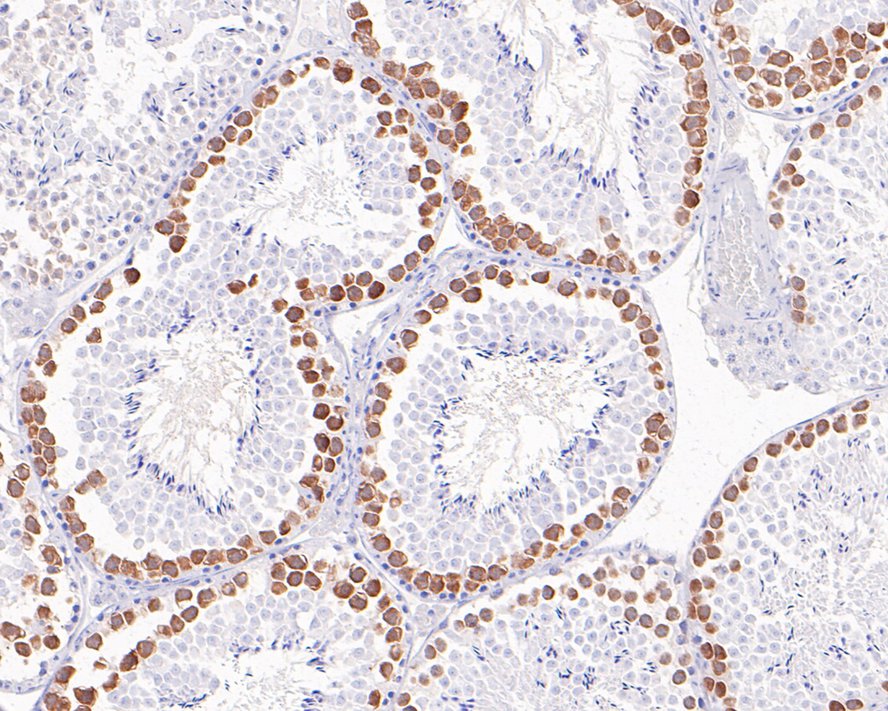 Immunohistochemical analysis of paraffin-embedded human tonsil tissue using anti-CDK1 antibody. The section was pre-treated using heat mediated antigen retrieval with Tris-EDTA buffer (pH 8.0-8.4) for 20 minutes.The tissues were blocked in 5% BSA for 30 minutes at room temperature, washed with ddH2O and PBS, and then probed with the primary antibody (ET1607-51, 1/50) for 30 minutes at room temperature. The detection was performed using an HRP conjugated compact polymer system. DAB was used as the chromogen. Tissues were counterstained with hematoxylin and mounted with DPX.