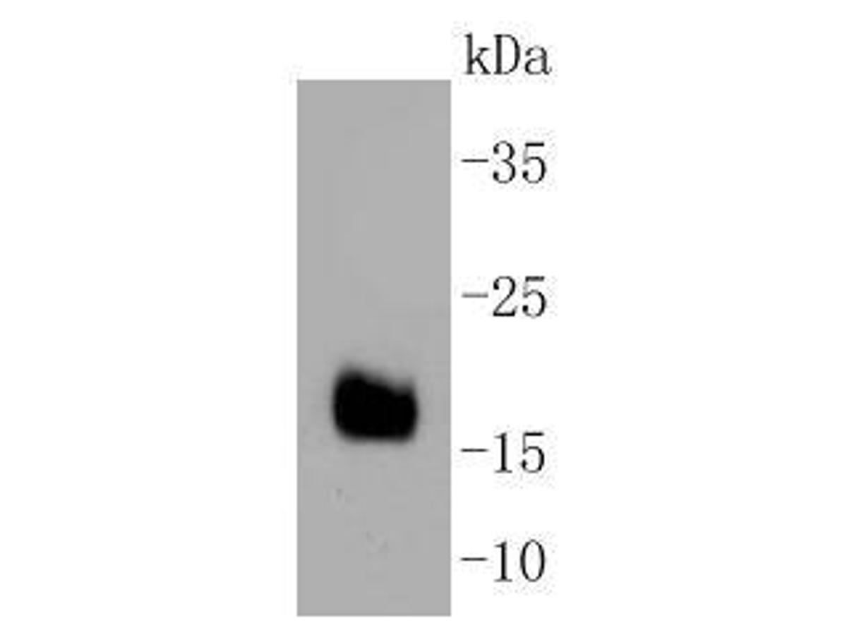 Western blot analysis of DNAJC15 on human liver tissue lysates. Proteins were transferred to a PVDF membrane and blocked with 5% BSA in PBS for 1 hour at room temperature. The primary antibody (ET1607-52, 1/500) was used in 5% BSA at room temperature for 2 hours. Goat Anti-Rabbit IgG - HRP Secondary Antibody (HA1001) at 1:5,000 dilution was used for 1 hour at room temperature.