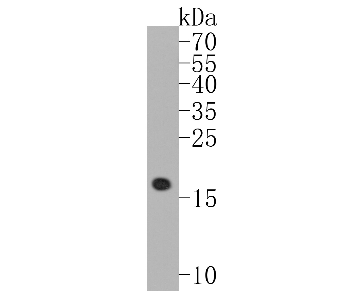 Western blot analysis of DNAJC15 on mouse heart tissue lysates. Proteins were transferred to a PVDF membrane and blocked with 5% BSA in PBS for 1 hour at room temperature. The primary antibody (ET1607-52, 1/500) was used in 5% BSA at room temperature for 2 hours. Goat Anti-Rabbit IgG - HRP Secondary Antibody (HA1001) at 1:5,000 dilution was used for 1 hour at room temperature.