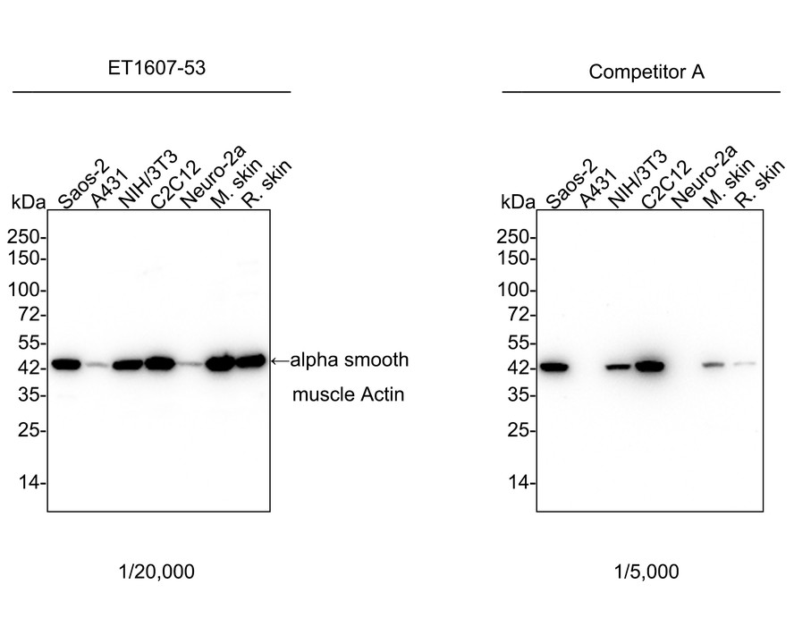 alpha smooth muscle Actin Recombinant Rabbit Monoclonal Antibody 