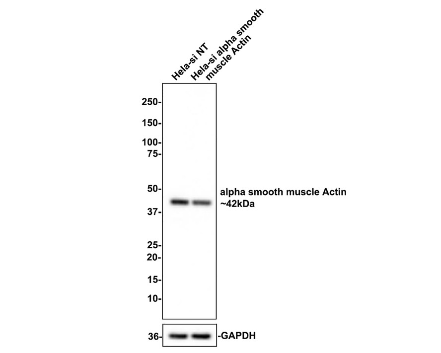 alpha smooth muscle Actin Recombinant Rabbit Monoclonal Antibody 