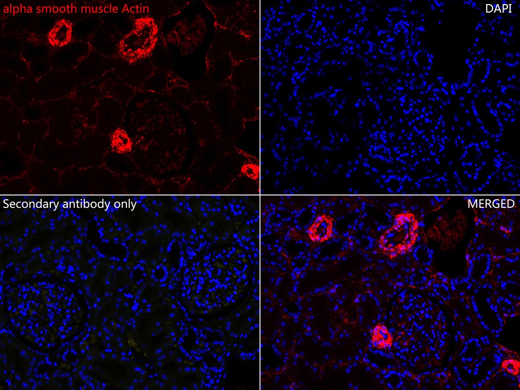 alpha smooth muscle Actin Recombinant Rabbit Monoclonal Antibody 