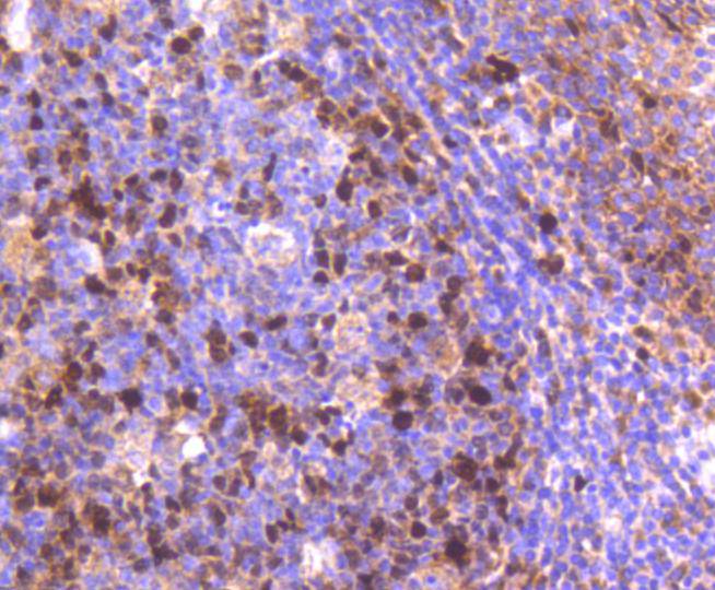Immunohistochemical analysis of paraffin-embedded human tonsil tissue using anti-Topoisomerase Ⅱ alpha antibody. The section was pre-treated using heat mediated antigen retrieval with Tris-EDTA buffer (pH 8.0-8.4) for 20 minutes.The tissues were blocked in 5% BSA for 30 minutes at room temperature, washed with ddH2O and PBS, and then probed with the primary antibody (ET1607-59, 1/50) for 30 minutes at room temperature. The detection was performed using an HRP conjugated compact polymer system. DAB was used as the chromogen. Tissues were counterstained with hematoxylin and mounted with DPX.