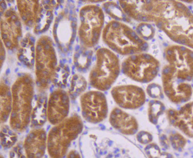 Immunohistochemical analysis of paraffin-embedded human kidney tissue using anti-Topoisomerase Ⅱ alpha antibody. The section was pre-treated using heat mediated antigen retrieval with Tris-EDTA buffer (pH 8.0-8.4) for 20 minutes.The tissues were blocked in 5% BSA for 30 minutes at room temperature, washed with ddH2O and PBS, and then probed with the primary antibody (ET1607-59, 1/50) for 30 minutes at room temperature. The detection was performed using an HRP conjugated compact polymer system. DAB was used as the chromogen. Tissues were counterstained with hematoxylin and mounted with DPX.