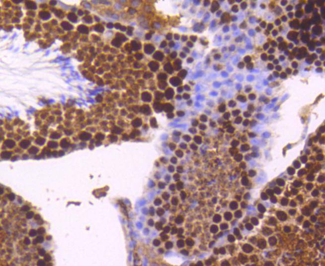 Immunohistochemical analysis of paraffin-embedded mouse testis tissue using anti-Topoisomerase Ⅱ alpha antibody. The section was pre-treated using heat mediated antigen retrieval with Tris-EDTA buffer (pH 8.0-8.4) for 20 minutes.The tissues were blocked in 5% BSA for 30 minutes at room temperature, washed with ddH2O and PBS, and then probed with the primary antibody (ET1607-59, 1/50) for 30 minutes at room temperature. The detection was performed using an HRP conjugated compact polymer system. DAB was used as the chromogen. Tissues were counterstained with hematoxylin and mounted with DPX.