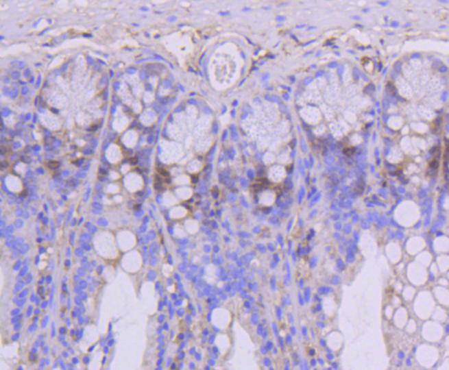 Immunohistochemical analysis of paraffin-embedded mouse colon tissue using anti-Topoisomerase Ⅱ alpha antibody. The section was pre-treated using heat mediated antigen retrieval with Tris-EDTA buffer (pH 8.0-8.4) for 20 minutes.The tissues were blocked in 5% BSA for 30 minutes at room temperature, washed with ddH2O and PBS, and then probed with the primary antibody (ET1607-59, 1/50) for 30 minutes at room temperature. The detection was performed using an HRP conjugated compact polymer system. DAB was used as the chromogen. Tissues were counterstained with hematoxylin and mounted with DPX.