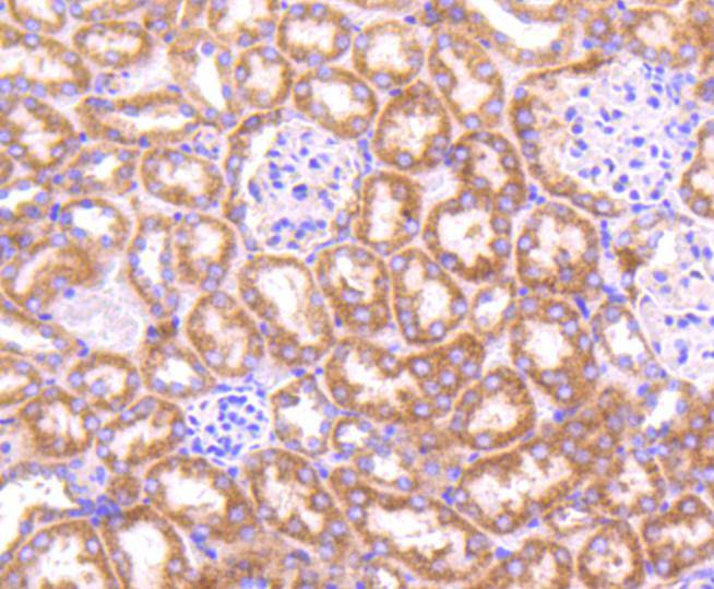 Immunohistochemical analysis of paraffin-embedded mouse kidney tissue using anti-Topoisomerase Ⅱ alpha antibody. The section was pre-treated using heat mediated antigen retrieval with Tris-EDTA buffer (pH 8.0-8.4) for 20 minutes.The tissues were blocked in 5% BSA for 30 minutes at room temperature, washed with ddH2O and PBS, and then probed with the primary antibody (ET1607-59, 1/50) for 30 minutes at room temperature. The detection was performed using an HRP conjugated compact polymer system. DAB was used as the chromogen. Tissues were counterstained with hematoxylin and mounted with DPX.