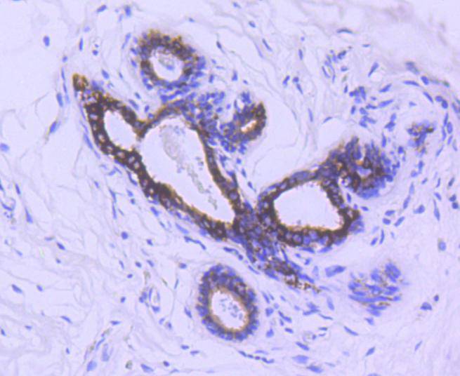 Immunohistochemical analysis of paraffin-embedded human kidney tissue using anti-Phospho-GSK3 beta(Ser 9) antibody. The section was pre-treated using heat mediated antigen retrieval with Tris-EDTA buffer (pH 8.0-8.4) for 20 minutes.The tissues were blocked in 5% BSA for 30 minutes at room temperature, washed with ddH2O and PBS, and then probed with the primary antibody (ET1607-60, 1/50) for 30 minutes at room temperature. The detection was performed using an HRP conjugated compact polymer system. DAB was used as the chromogen. Tissues were counterstained with hematoxylin and mounted with DPX.