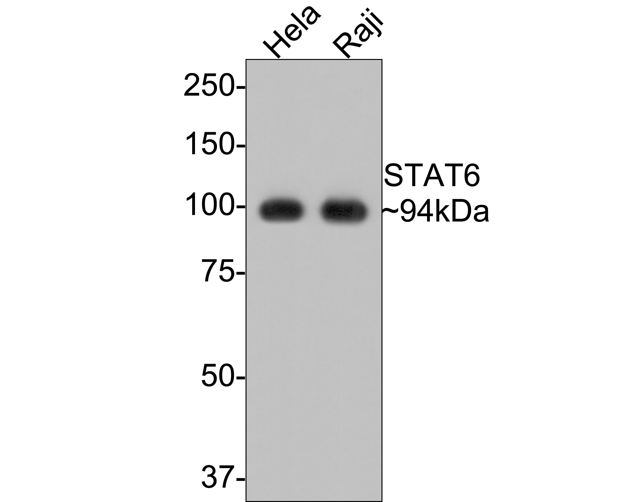Western blot analysis of STAT6 on different lysates with Rabbit anti-STAT6 antibody (ET1607-61) at 1/500 dilution.<br />
<br />
Lane 1: Hela cell lysate<br />
Lane 2: Raji cell lysate<br />
<br />
Lysates/proteins at 10 µg/Lane.<br />
<br />
Predicted band size: 94 kDa<br />
Observed band size: 94 kDa<br />
<br />
Exposure time: 30 seconds;<br />
<br />
8% SDS-PAGE gel.<br />
<br />
Proteins were transferred to a PVDF membrane and blocked with 5% NFDM/TBST for 1 hour at room temperature. The primary antibody (ET1607-61) at 1/500 dilution was used in 5% NFDM/TBST at room temperature for 2 hours. Goat Anti-Rabbit IgG - HRP Secondary Antibody (HA1001) at 1:300,000 dilution was used for 1 hour at room temperature.