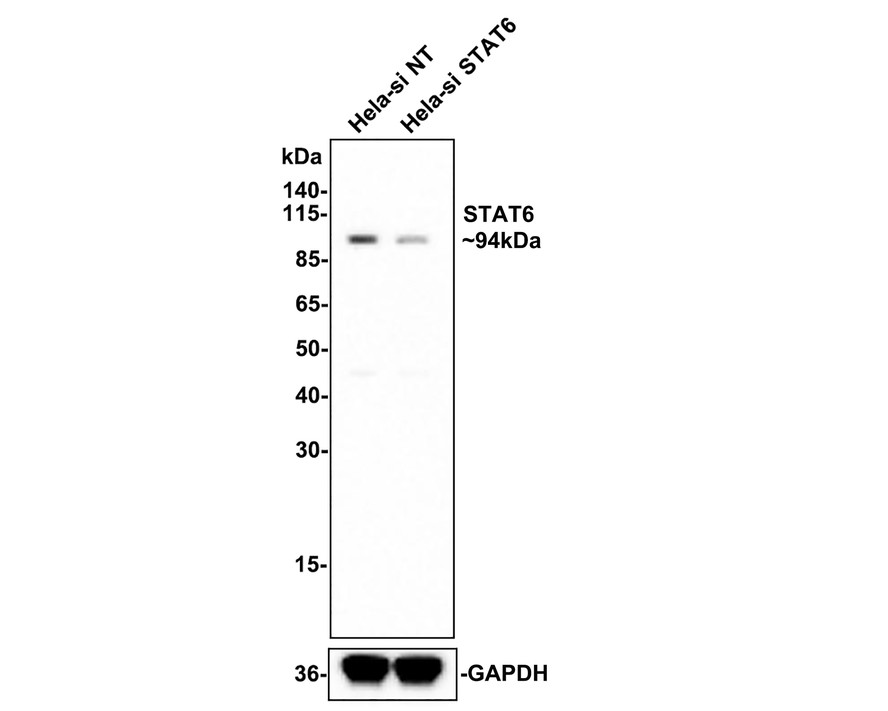 Western blot analysis of STAT6 on different lysates with Rabbit anti-STAT6 antibody (ET1607-61) at 1/500 dilution.<br />
<br />
Lane 1: Hela-si-NT cell lysate<br />
Lane 2: Hela-si-STAT6 cell lysate<br />
<br />
Lysates/proteins at 10 µg/Lane.<br />
<br />
Predicted band size: 94 kDa<br />
Observed band size: 94 kDa<br />
<br />
Exposure time: 3 minutes;<br />
<br />
4-20% SDS-PAGE gel.<br />
<br />
ET1607-61 was shown to specifically react with STAT6 in Hela-si-NT cells. Weakened band was observed when Hela-si-STAT6 sample was tested. Hela-si-NT and Hela-si-STAT6 samples were subjected to SDS-PAGE. Proteins were transferred to a PVDF membrane and blocked with 5% NFDM in TBST for 1 hour at room temperature. The primary antibody (ET1607-61, 1/500) and Loading control antibody (Rabbit anti-GAPDH, ET1601-4, 1/10,000) were used in 5% BSA at room temperature for 2 hours. Goat Anti-rabbit IgG-HRP Secondary Antibody (HA1001) at 1:300,000 dilution was used for 1 hour at room temperature.