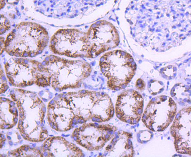 Immunohistochemical analysis of paraffin-embedded human kidney tissue with Rabbit anti-STAT6 antibody (ET1607-61) at 1/50 dilution.<br />
<br />
The section was pre-treated using heat mediated antigen retrieval with Tris-EDTA buffer (pH 9.0) for 20 minutes. The tissues were blocked in 1% BSA for 20 minutes at room temperature, washed with ddH2O and PBS, and then probed with the primary antibody (ET1607-61) at 1/50 dilution for 1 hour at room temperature. The detection was performed using an HRP conjugated compact polymer system. DAB was used as the chromogen. Tissues were counterstained with hematoxylin and mounted with DPX.