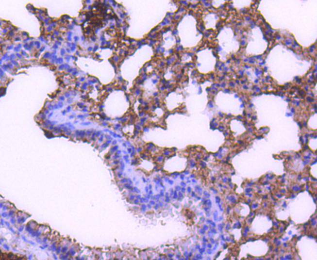 Immunohistochemical analysis of paraffin-embedded mouse lung tissue with Rabbit anti-STAT6 antibody (ET1607-61) at 1/20 dilution.<br />
<br />
The section was pre-treated using heat mediated antigen retrieval with Tris-EDTA buffer (pH 9.0) for 20 minutes. The tissues were blocked in 1% BSA for 20 minutes at room temperature, washed with ddH2O and PBS, and then probed with the primary antibody (ET1607-61) at 1/20 dilution for 1 hour at room temperature. The detection was performed using an HRP conjugated compact polymer system. DAB was used as the chromogen. Tissues were counterstained with hematoxylin and mounted with DPX.
