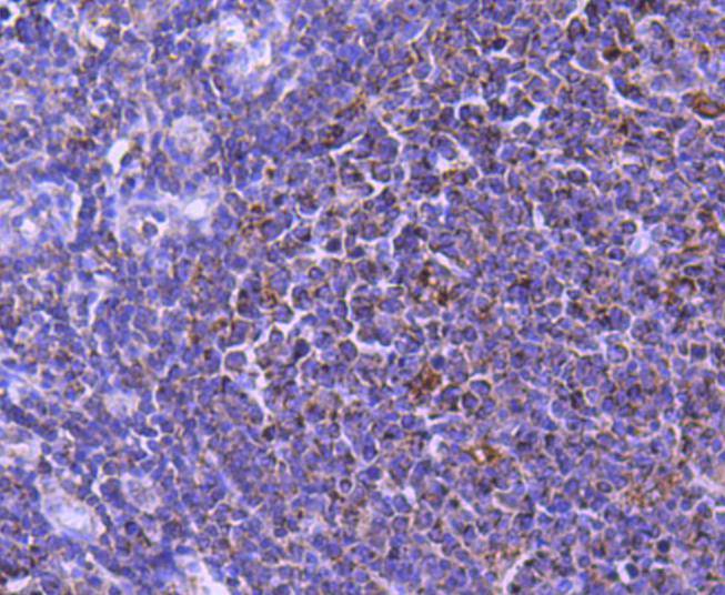 Immunohistochemical analysis of paraffin-embedded human tonsil tissue with Rabbit anti-STAT6 antibody (ET1607-61) at 1/50 dilution.<br />
<br />
The section was pre-treated using heat mediated antigen retrieval with Tris-EDTA buffer (pH 9.0) for 20 minutes. The tissues were blocked in 1% BSA for 20 minutes at room temperature, washed with ddH2O and PBS, and then probed with the primary antibody (ET1607-61) at 1/50 dilution for 1 hour at room temperature. The detection was performed using an HRP conjugated compact polymer system. DAB was used as the chromogen. Tissues were counterstained with hematoxylin and mounted with DPX.