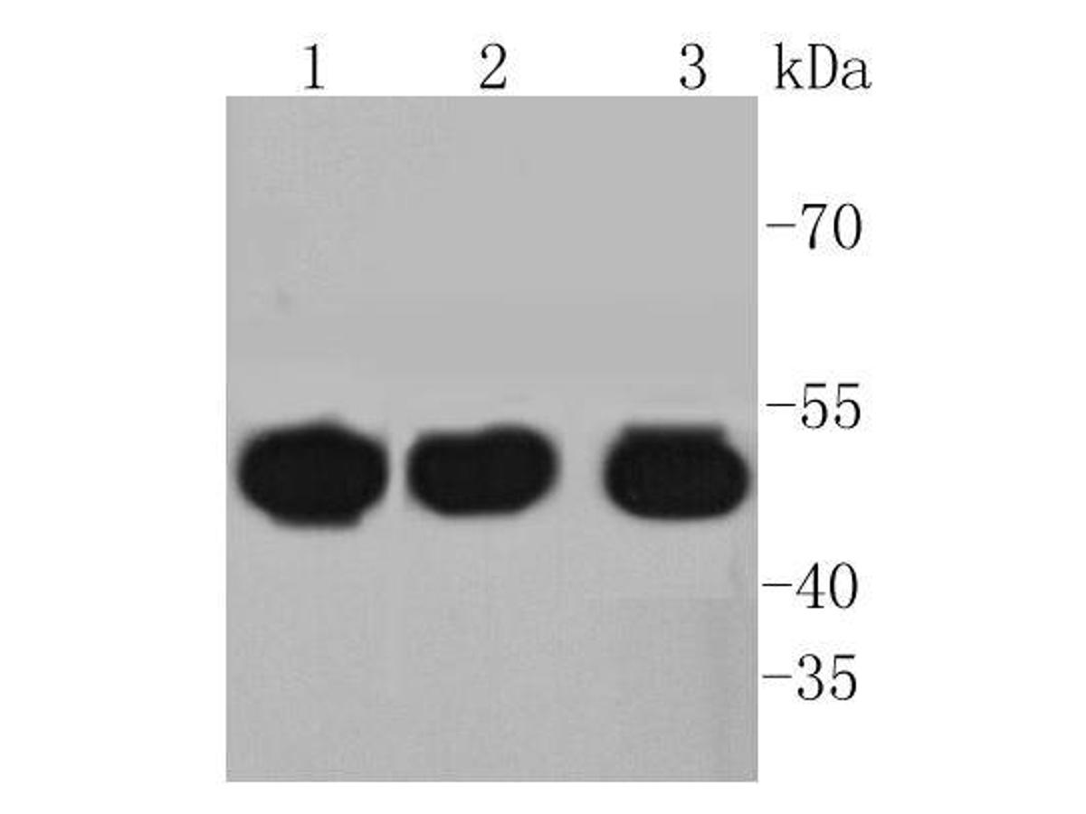 Western blot analysis of HAPLN1 on different lysates. Proteins were transferred to a PVDF membrane and blocked with 5% BSA in PBS for 1 hour at room temperature. The primary antibody (ET1607-7, 1/500) was used in 5% BSA at room temperature for 2 hours. Goat Anti-Rabbit IgG - HRP Secondary Antibody (HA1001) at 1:5,000 dilution was used for 1 hour at room temperature.<br />
Positive control:<br />
Lane 1: BT-20 cell lysate<br />
Lane 2: HUVEC cell lysate<br />
Lane 3: SW480 cell lysate