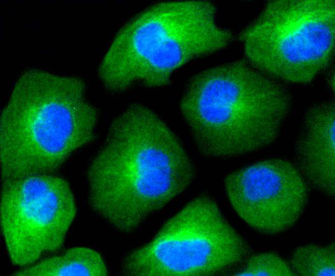 ICC staining of HAPLN1 in HUVEC cells (green). Formalin fixed cells were permeabilized with 0.1% Triton X-100 in TBS for 10 minutes at room temperature and blocked with 1% Blocker BSA for 15 minutes at room temperature. Cells were probed with the primary antibody (ET1607-7, 1/50) for 1 hour at room temperature, washed with PBS. Alexa Fluor®488 Goat anti-Rabbit IgG was used as the secondary antibody at 1/1,000 dilution. The nuclear counter stain is DAPI (blue).