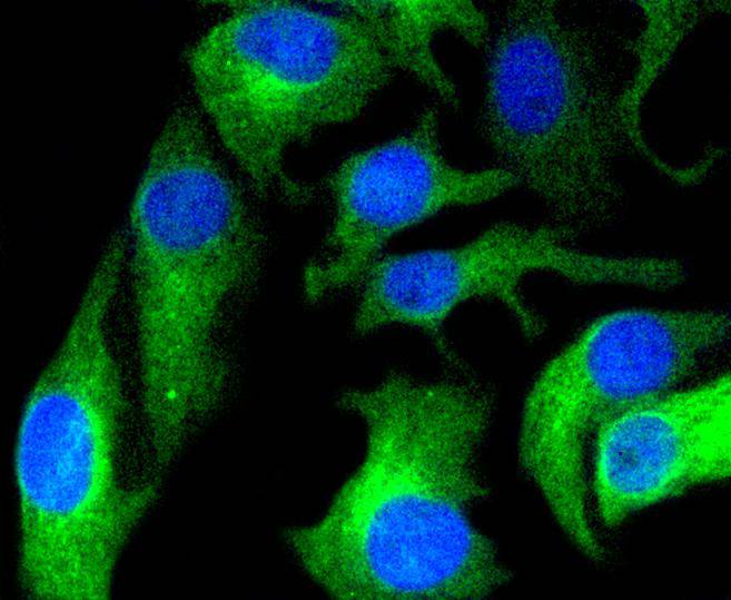 ICC staining of HAPLN1 in BT-20 cells (green). Formalin fixed cells were permeabilized with 0.1% Triton X-100 in TBS for 10 minutes at room temperature and blocked with 1% Blocker BSA for 15 minutes at room temperature. Cells were probed with the primary antibody (ET1607-7, 1/50) for 1 hour at room temperature, washed with PBS. Alexa Fluor®488 Goat anti-Rabbit IgG was used as the secondary antibody at 1/1,000 dilution. The nuclear counter stain is DAPI (blue).